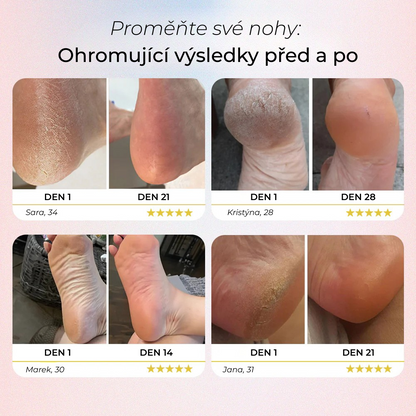 Rimuovi calli elettrico per piedi Yuna